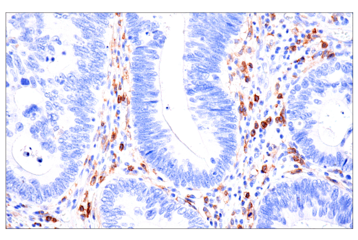 Immunohistochemistry Image 1: CD4 (EP204) Rabbit Monoclonal Antibody