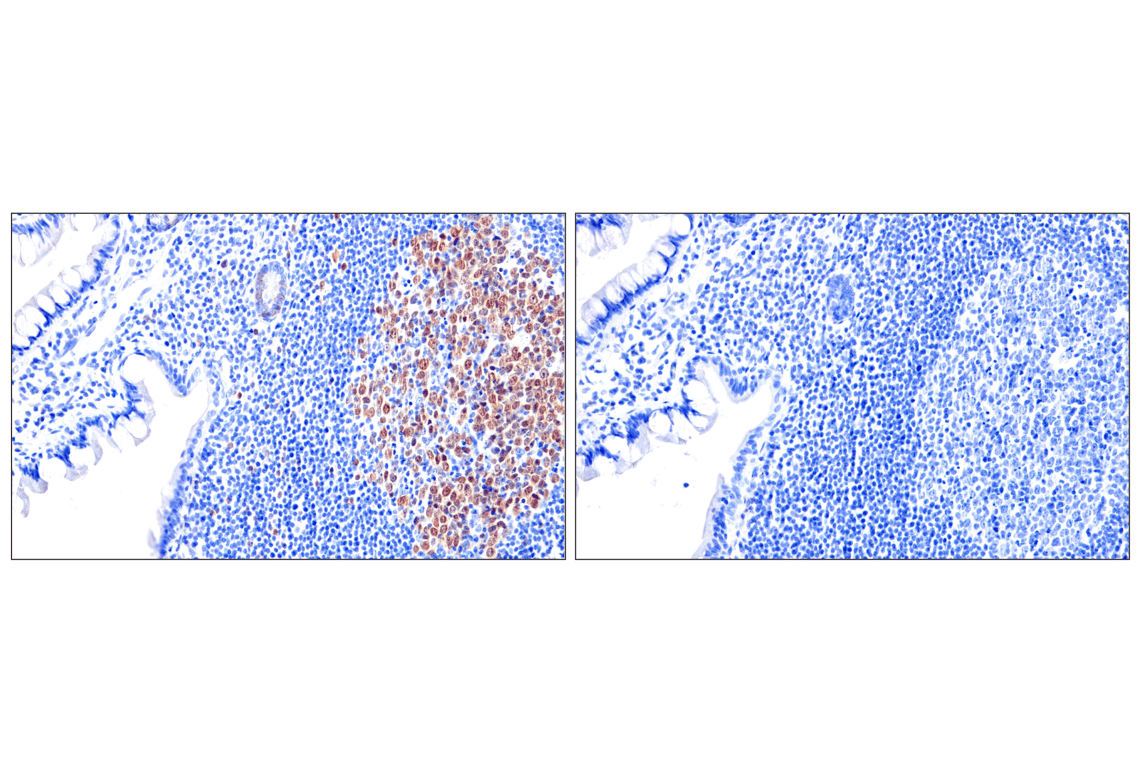 undefined Image 36: Phospho-Chk1/2 Antibody Sampler Kit