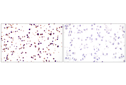 Immunohistochemistry Image 4: Neutrophil Elastase (E8U3X) Rabbit Monoclonal Antibody (BSA and Azide Free)