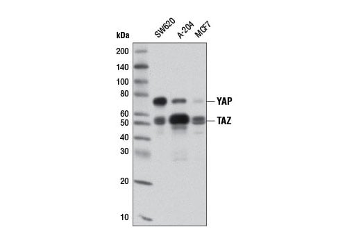 undefined Image 9: Hippo Signaling Antibody Sampler Kit