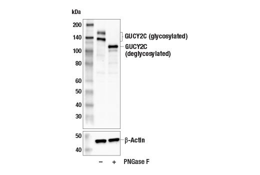 Western Blotting Image 2: GUCY2C (E1Q6S) Rabbit Monoclonal Antibody