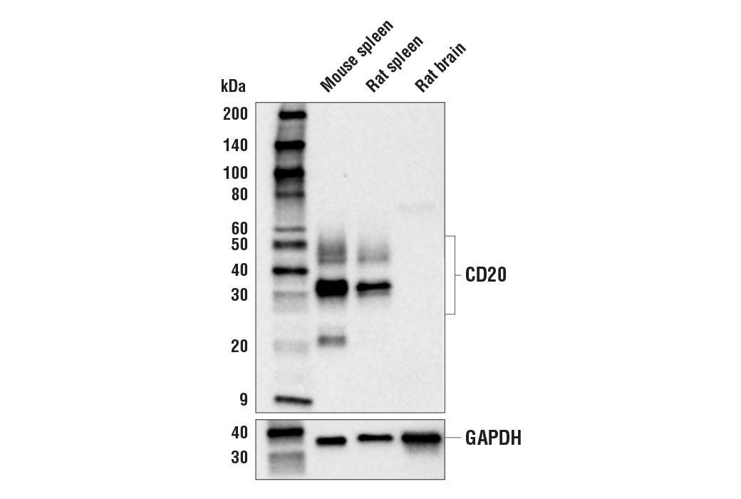 Western Blotting Image 2: CD20 (E3N7O) Rabbit Monoclonal Antibody