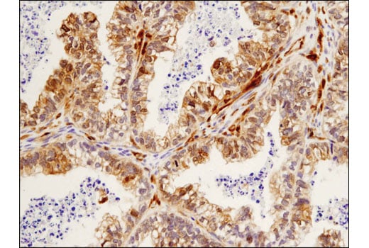 Immunohistochemistry Image 2: beta-Arrestin 1 (D7Z3W) Rabbit Monoclonal Antibody