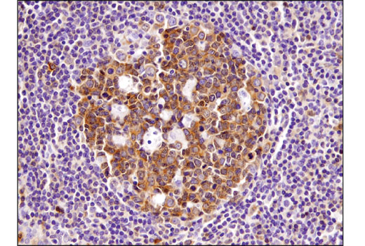 Immunohistochemistry Image 4: HDAC7 (D4E1L) Rabbit Monoclonal Antibody