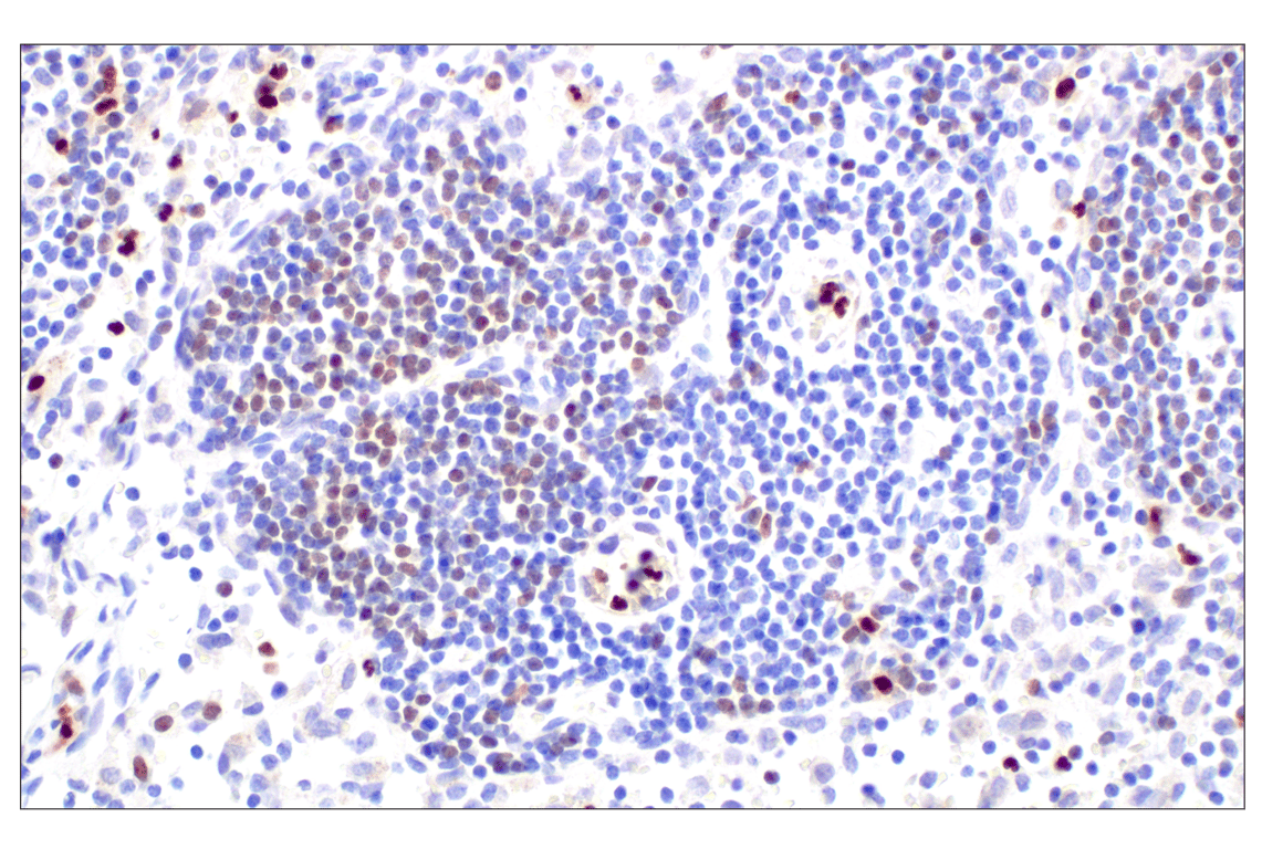 Immunohistochemistry Image 6: MNDA (3C1) Rat Monoclonal Antibody