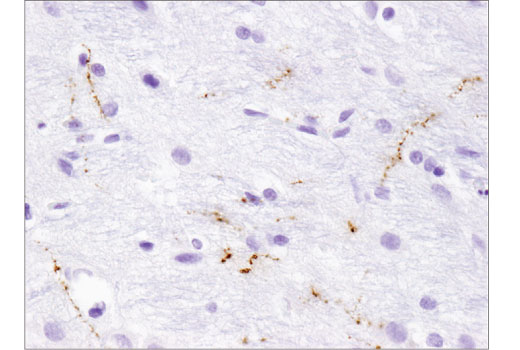 Immunohistochemistry Image 3: Orexin (D6G9T) Rabbit Monoclonal Antibody