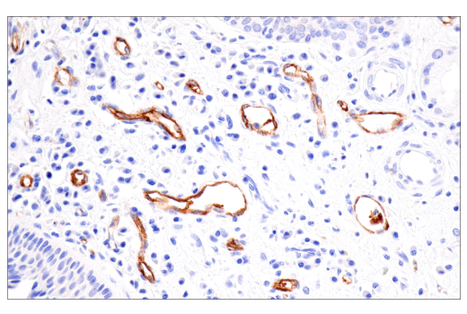 Immunohistochemistry Image 1: CD62P/P-Selectin (E8Q1W) Rabbit Monoclonal Antibody