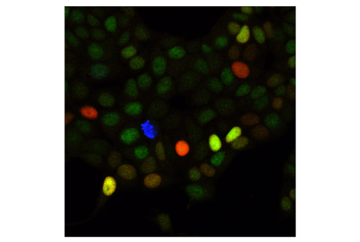 Immunofluorescence Image 1: CDK4 (D9G3E) Rabbit Monoclonal Antibody (BSA and Azide Free)