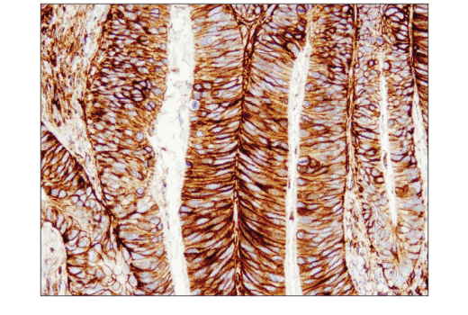 CD44 (E7K2Y) XP® Rabbit mAb | Cell Signaling Technology