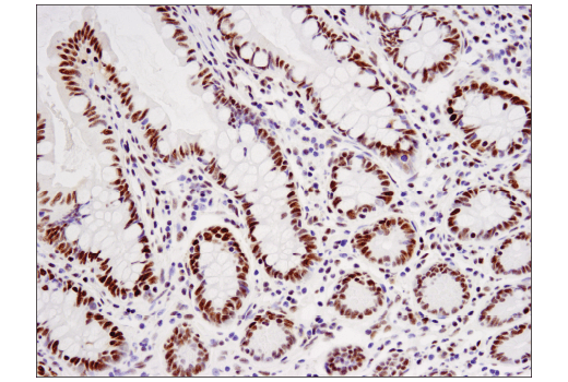 Immunohistochemistry Image 3: WHSC1L1 (D4N9N) Rabbit Monoclonal Antibody (BSA and Azide Free)