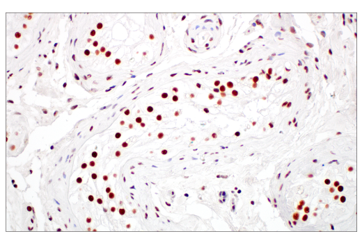 Immunohistochemistry Image 6: XRCC1 (E4A3V) Rabbit Monoclonal Antibody