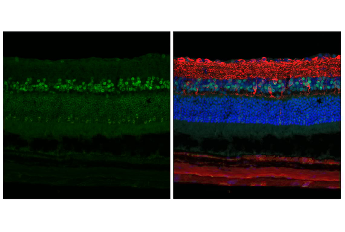 Immunofluorescence Image 2: NeuroD1 (E3E4F) Rabbit Monoclonal Antibody