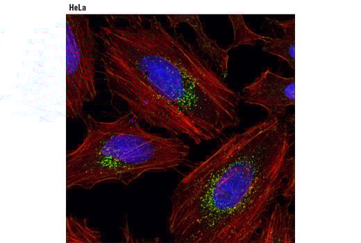 Immunofluorescence Image 1: LAMTOR4/C7orf59 (D6A4V) Rabbit Monoclonal Antibody