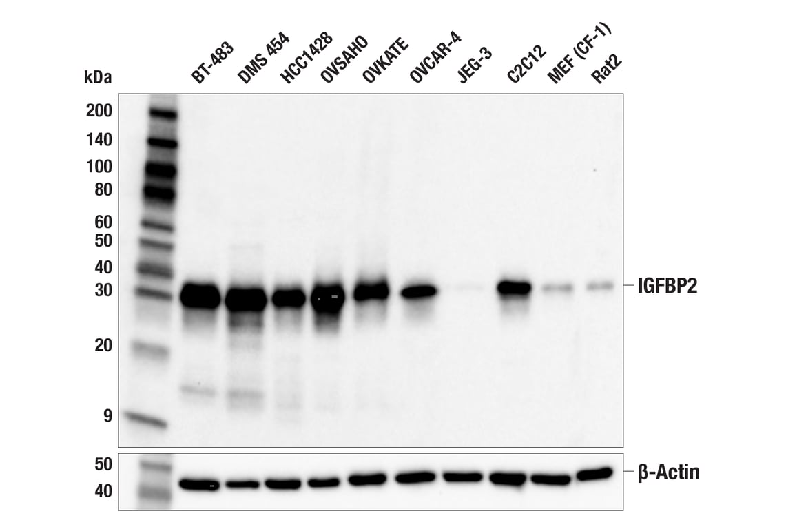 Western Blotting Image 2: IGFBP2 (F3E6V) Rabbit Monoclonal Antibody