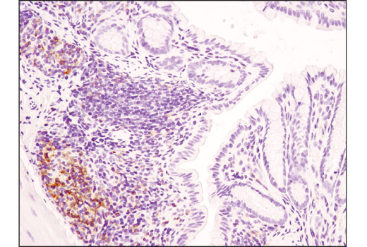 Immunohistochemistry Image 1: CD4 (D7D2Z) Rabbit mAb