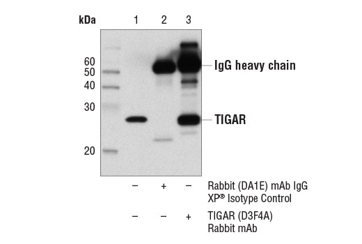 Immunoprecipitation Image 1: TIGAR (D3F4A) Rabbit Monoclonal Antibody