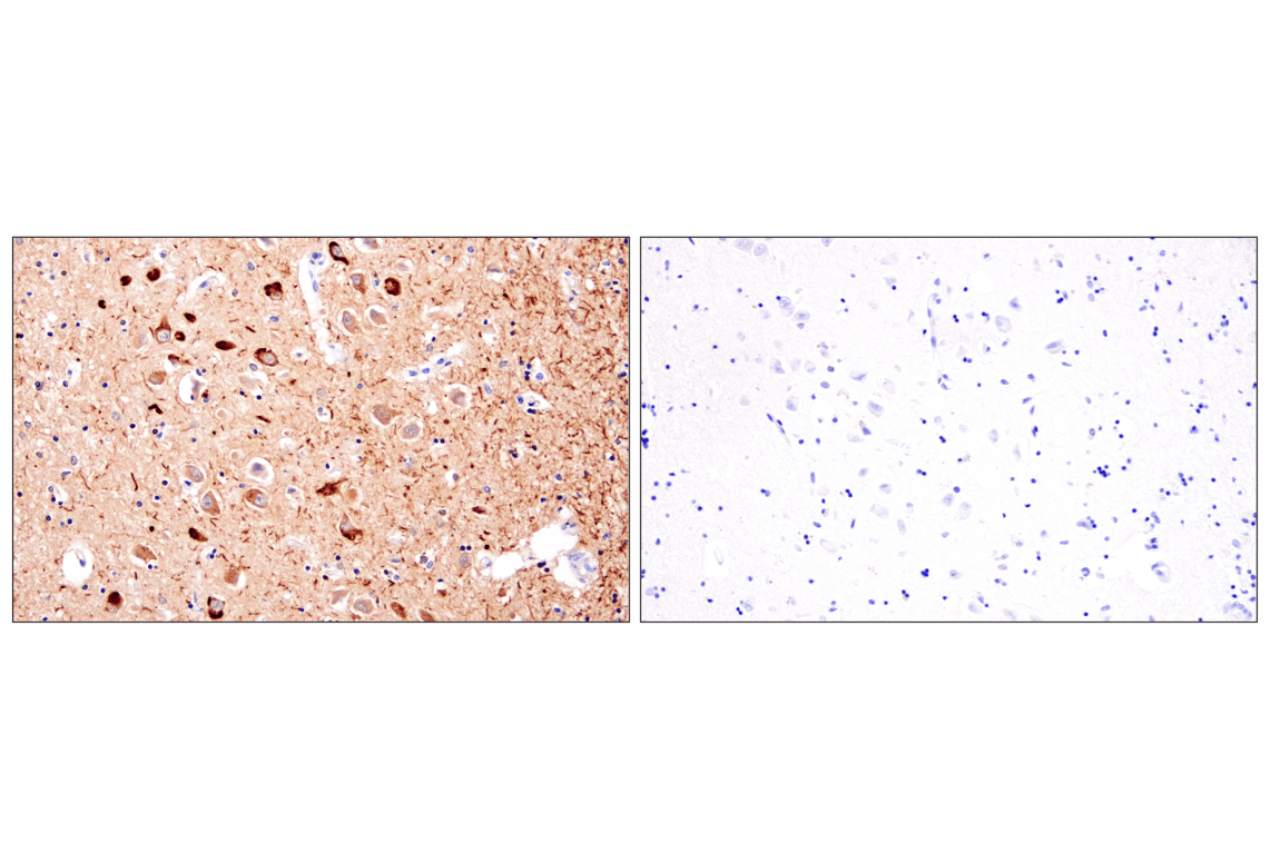 Immunohistochemistry Image 6: Phospho-Tau (Ser202) (F2A2F) Rabbit Monoclonal Antibody