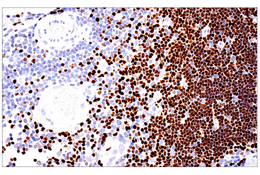 Immunohistochemistry Image 7: SATB1 (E5Z3U) Rabbit Monoclonal Antibody