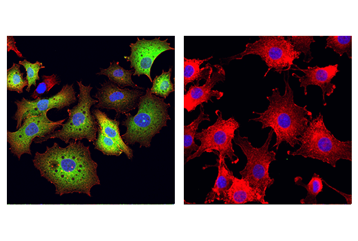 Immunofluorescence Image 1: Tyrosine Hydroxylase (A8Y7R) Rabbit Monoclonal Antibody