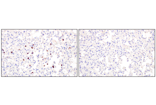 Immunohistochemistry Image 3: CD20 (E3N7O) Rabbit Monoclonal Antibody (BSA and Azide Free)