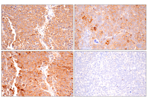 Immunohistochemistry Image 10: B-Raf (E3T5C) Mouse Monoclonal Antibody (BSA and Azide Free)