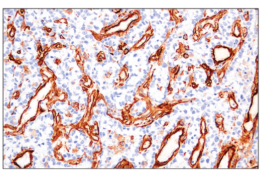 Immunohistochemistry Image 2: CD141/Thrombomodulin (E7Y9P) Rabbit Monoclonal Antibody