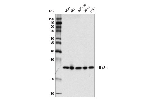 Western Blotting Image 2: TIGAR (D3F4A) Rabbit Monoclonal Antibody