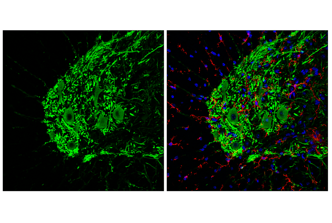 Immunofluorescence Image 2: GPR52 (E9D8W) Rabbit Monoclonal Antibody (BSA and Azide Free)