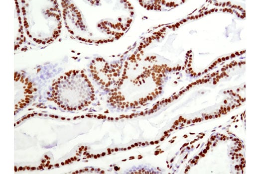 Immunohistochemistry Image 1: Histone H2B (D2H6) Rabbit Monoclonal Antibody