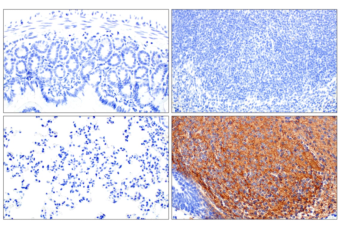 Immunohistochemistry Image 4: Doublecortin (E3S7L) Rabbit Monoclonal Antibody
