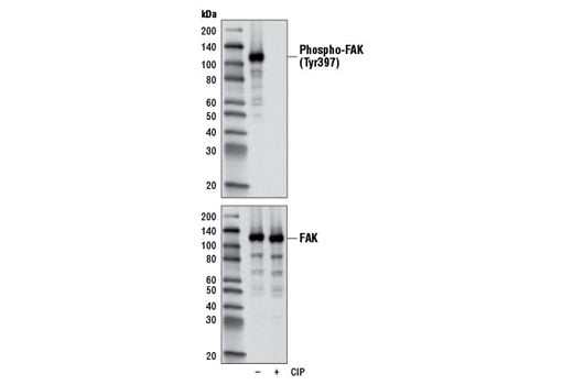 undefined Image 7: Angiogenesis Antibody Sampler Kit