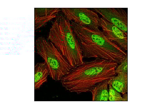 Immunofluorescence Image 1: PP2C-alpha (D18C10) Rabbit Monoclonal Antibody