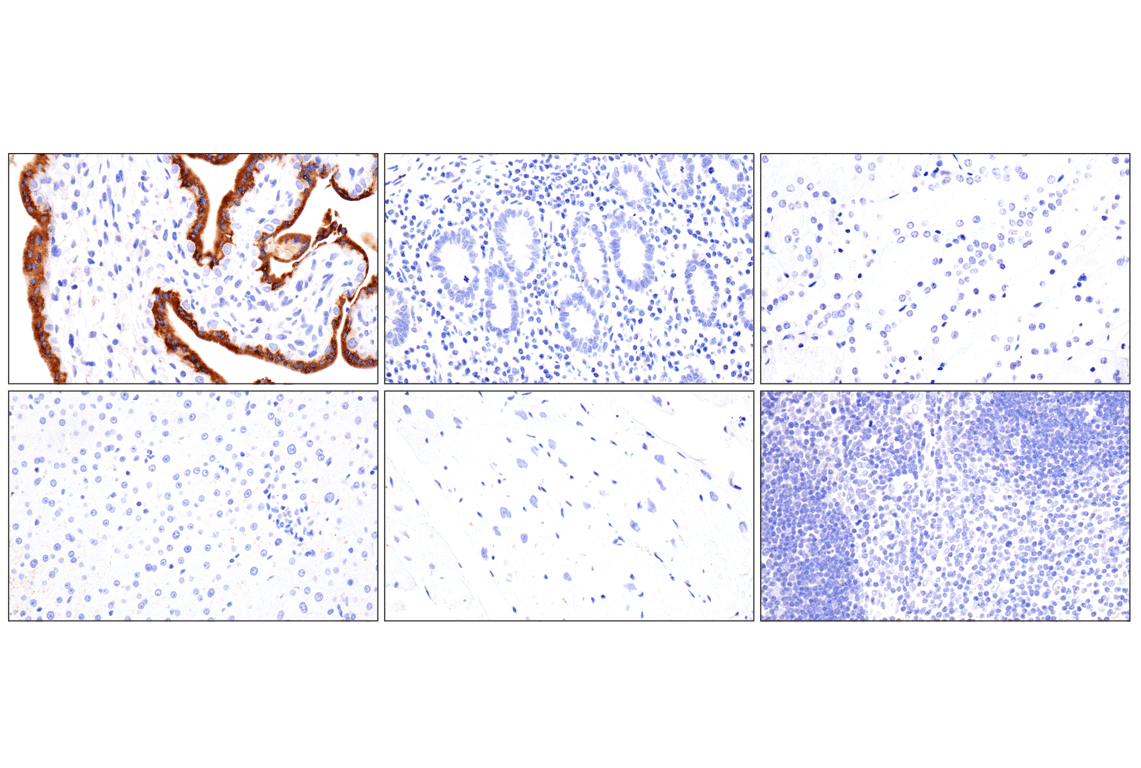 Immunohistochemistry Image 2: KISS1 (E6H9S) Rabbit Monoclonal Antibody