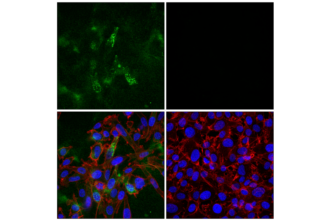 Immunofluorescence Image 1: DKK1 (F1D4I) Rabbit Monoclonal Antibody (BSA and Azide Free)