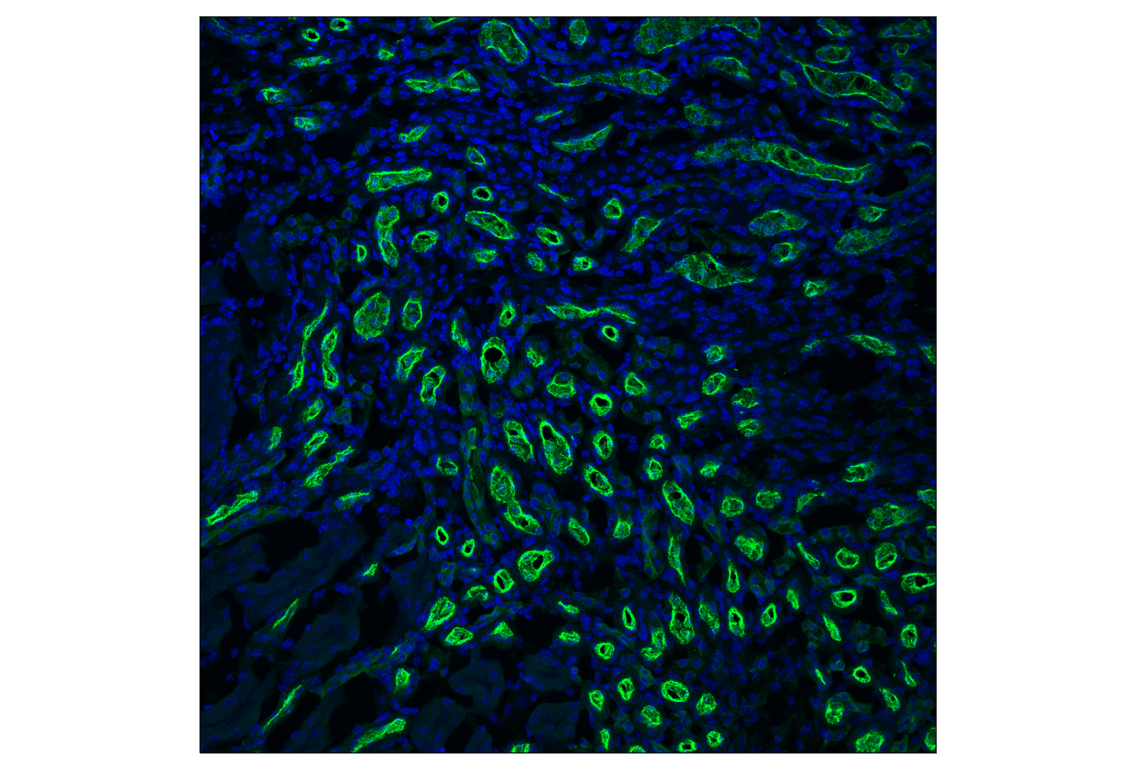 Immunofluorescence Image 2: SPAK (F7T1K) Rabbit Monoclonal Antibody