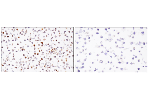Immunohistochemistry Image 3: BCL6 (E5I8I) Rabbit Monoclonal Antibody (BSA and Azide Free)