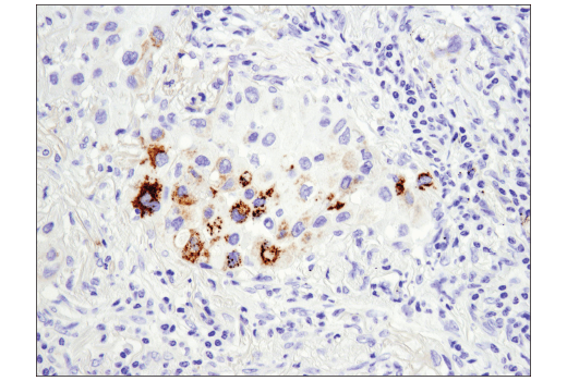 Immunohistochemistry Image 3: Arginase-2 (D9J1N) Rabbit Monoclonal Antibody