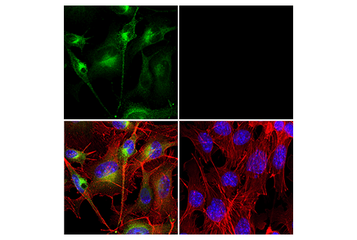 Immunofluorescence Image 1: GPNMB (E7U1Z) Rabbit Monoclonal Antibody