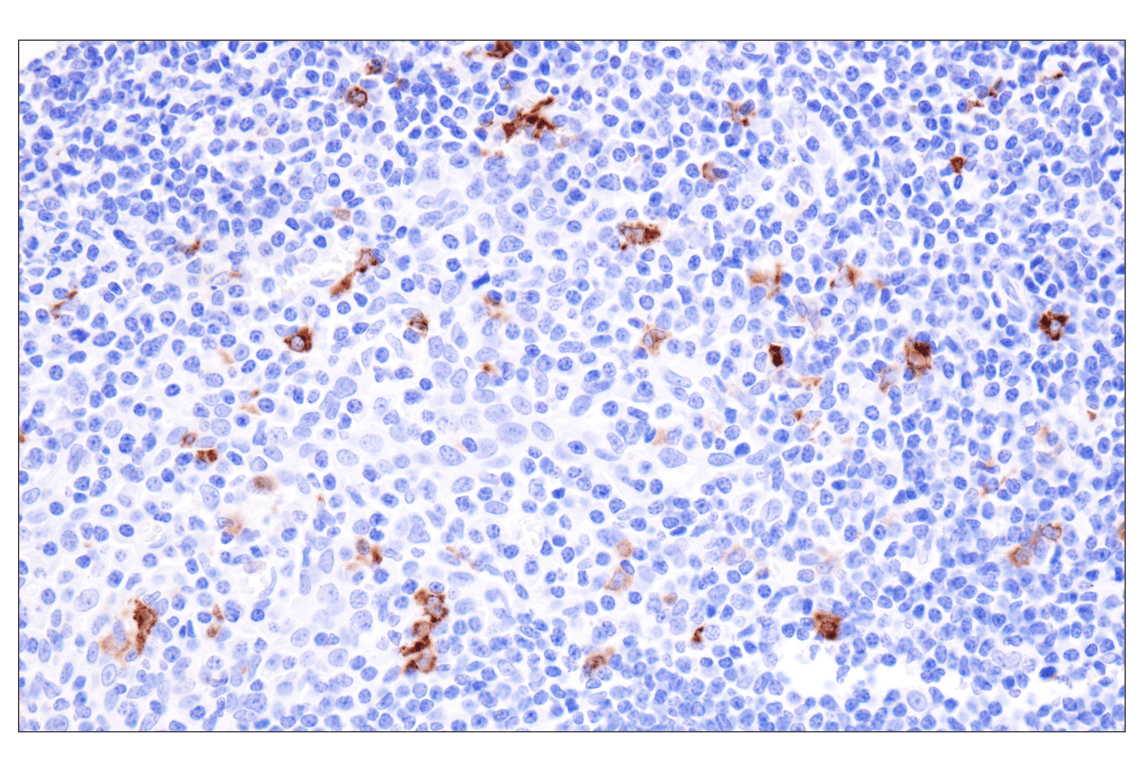 Immunohistochemistry Image 9: Langerin (F8L8I) Rabbit Monoclonal Antibody