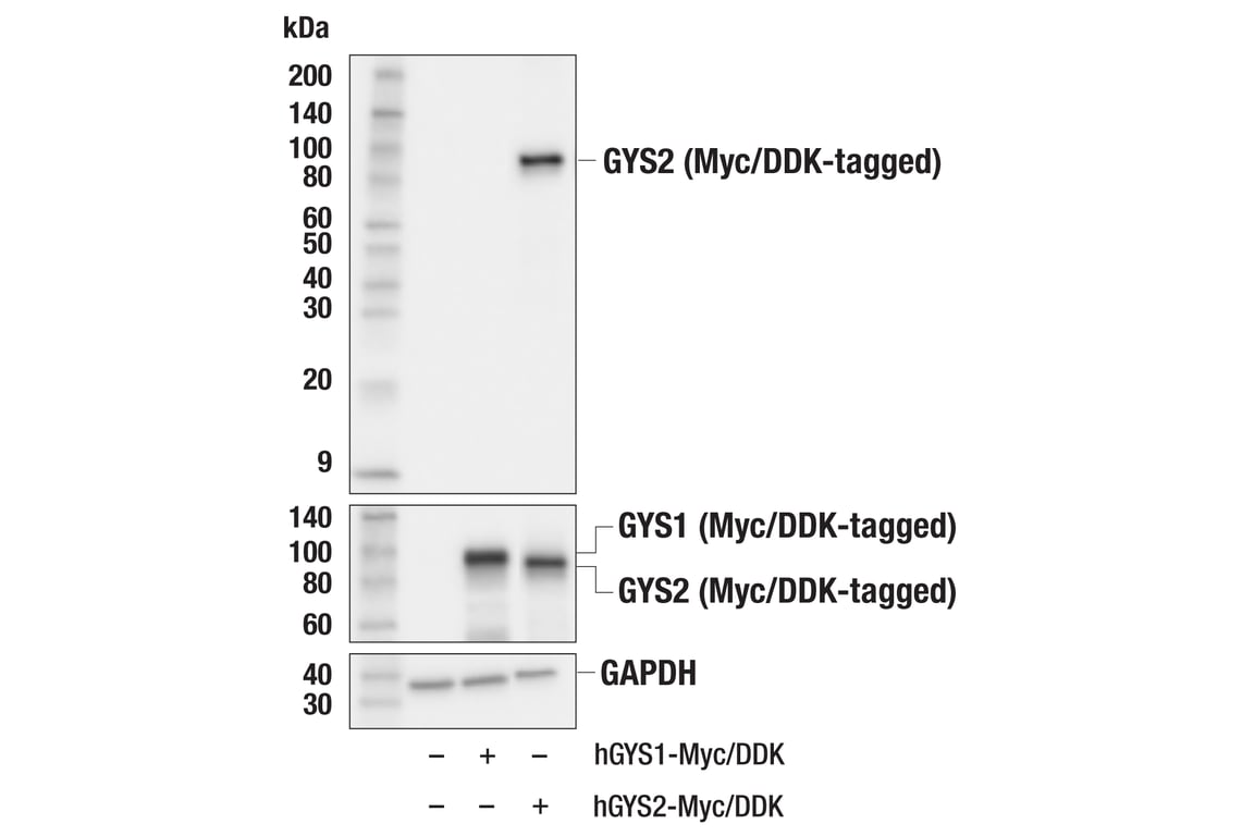 Western Blotting Image 2: Glycogen Synthase 2 (GYS2) (E5E4V) Rabbit Monoclonal Antibody