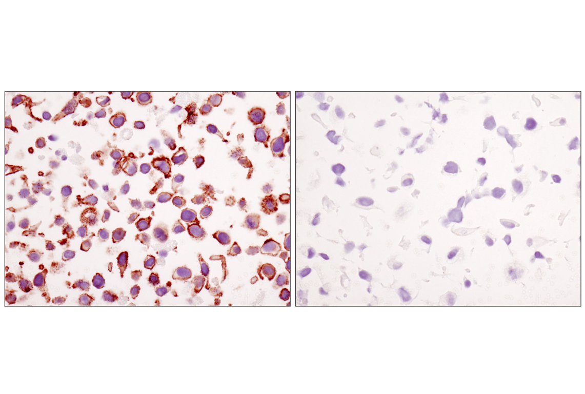 Immunohistochemistry Image 5: beta-Catenin (D10A8) Rabbit Monoclonal Antibody (BSA and Azide Free)