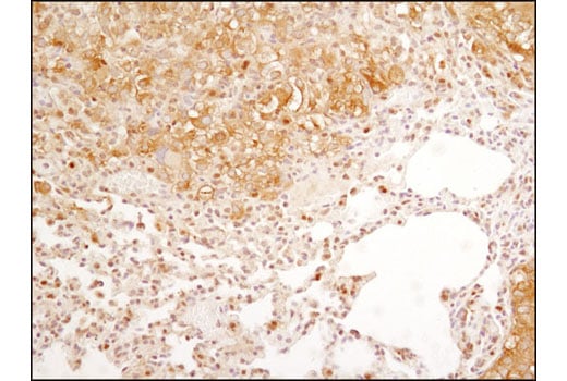 Immunohistochemistry Image 4: FoxO3a (D19A7) Rabbit Monoclonal Antibody
