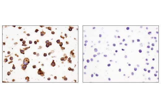 Immunohistochemistry Image 2: GITR (D9I9D) Rabbit mAb (BSA and Azide Free)