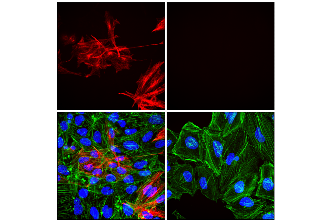 Immunofluorescence Image 1: GFAP (E4L7M) Rabbit Monoclonal Antibody (Alexa Fluor<sup>®</sup> 647 Conjugate)