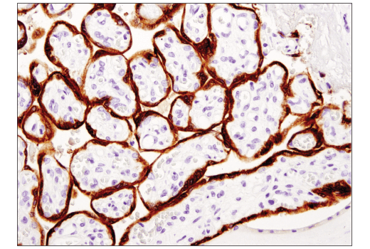 Immunohistochemistry Image 2: Aromatase (D5Q2Y) Rabbit Monoclonal Antibody