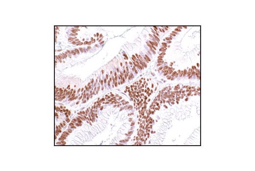 Immunohistochemistry Image 3: Phospho-Threonine-Proline Mouse Monoclonal Antibody (P-Thr-Pro-101)