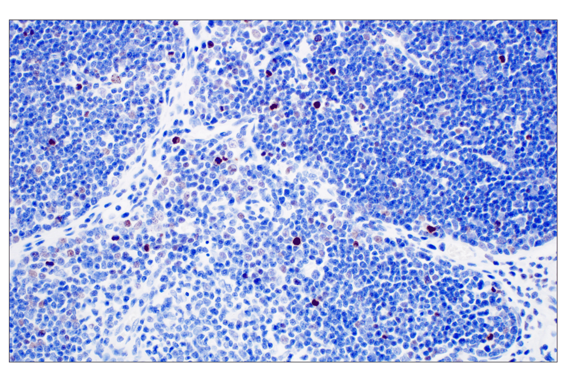 Immunohistochemistry Image 2: Phospho-Histone H3 (Ser10) (D7N8E) Rabbit Monoclonal Antibody