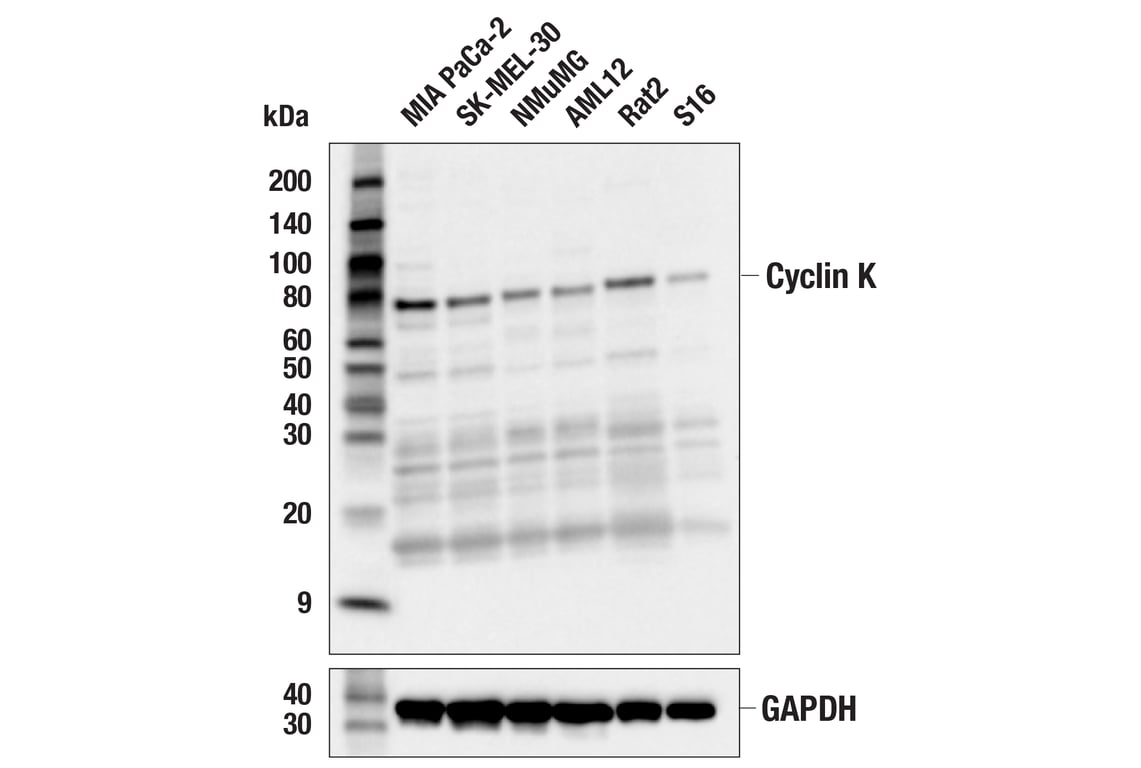 Western Blotting Image 3: Cyclin K (E7F4N) Rabbit Monoclonal Antibody