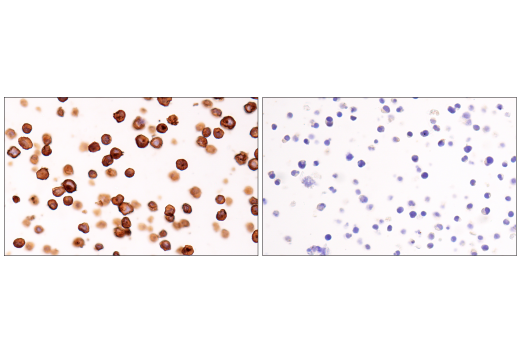 Immunohistochemistry Image 2: CD20 (L26) Mouse Monoclonal Antibody