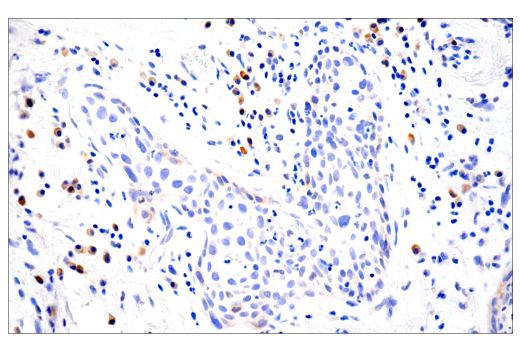 Immunohistochemistry Image 4: cGAS (E5V3W) Rabbit Monoclonal Antibody